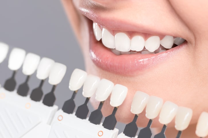 Obtain a brilliant smile with professional teeth whitening